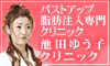 豊胸